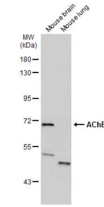 Western blot - Anti-Acetylcholinesterase antibody (AB97299)