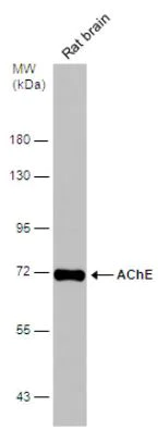 Western blot - Anti-Acetylcholinesterase antibody (AB97299)