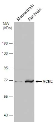 Western blot - Anti-Acetylcholinesterase antibody (AB97299)