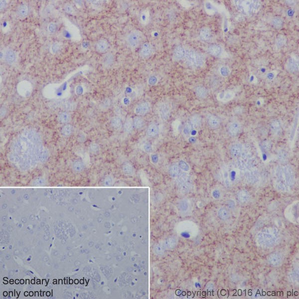 Immunohistochemistry (Formalin/PFA-fixed paraffin-embedded sections) - Anti-Acetylcholinesterase antibody [EPR18978] (AB183591), expandable thumbnail