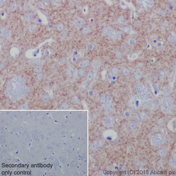 Immunohistochemistry (Formalin/PFA-fixed paraffin-embedded sections) - Anti-Acetylcholinesterase antibody [EPR18978] (AB183591)