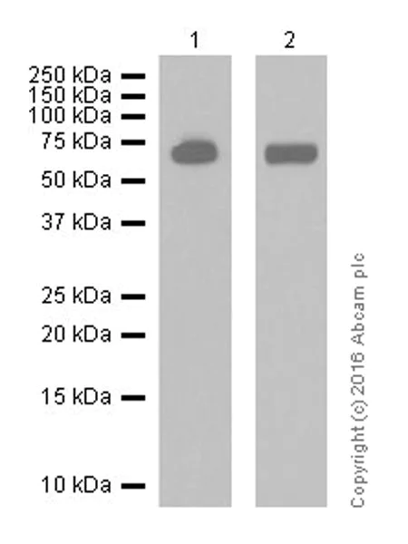 Western blot - Anti-Acetylcholinesterase antibody [EPR18978] (AB183591)