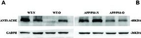 Western blot - Anti-Acetylcholinesterase antibody [EPR18978] (ab183591), expandable thumbnail