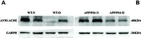 Western blot - Anti-Acetylcholinesterase antibody [EPR18978] (AB183591)
