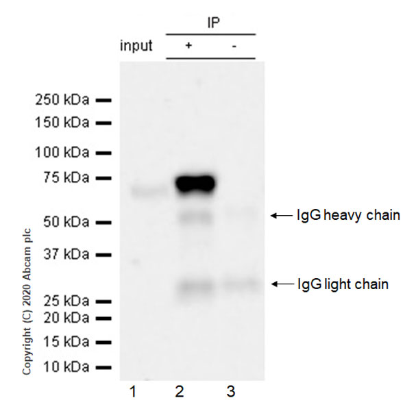 Immunoprecipitation - Anti-Acetylcholinesterase antibody [EPR23268-202] (AB253201)
