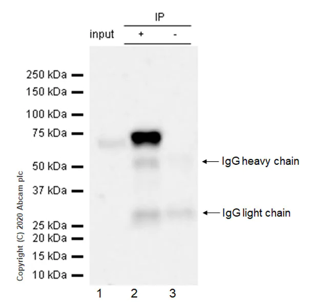 Immunoprecipitation - Anti-Acetylcholinesterase antibody [EPR23268-202] - BSA and Azide free (AB274388)