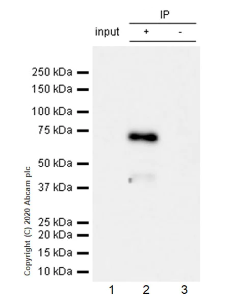 Immunoprecipitation - Anti-Acetylcholinesterase antibody [EPR23268-202] - BSA and Azide free (AB274388)