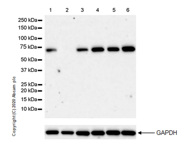 Western blot - Anti-Acetylcholinesterase antibody [EPR23268-202] - BSA and Azide free (AB274388)