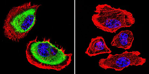 Immunocytochemistry/ Immunofluorescence - Anti-Acetylcholinesterase antibody [HR2] (AB2803)