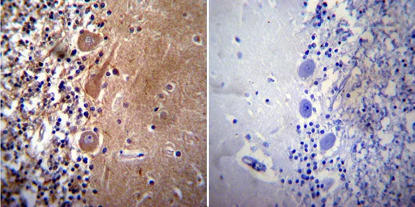 Immunohistochemistry (Formalin/PFA-fixed paraffin-embedded sections) - Anti-Acetylcholinesterase antibody [HR2] (AB2803)