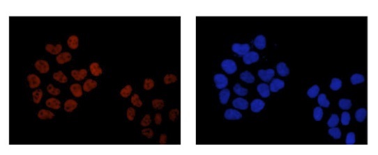 Immunocytochemistry/ Immunofluorescence - Anti-ACF1 / BAZ1A antibody [EPR15826] - C-terminal (AB187670)