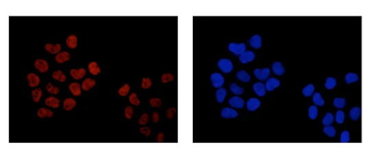 Immunocytochemistry/ Immunofluorescence - Anti-ACF1 / BAZ1A antibody [EPR15826] - C-terminal (AB187670)