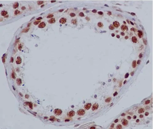 Immunohistochemistry (Formalin/PFA-fixed paraffin-embedded sections) - Anti-ACF1 / BAZ1A antibody [EPR15826] - C-terminal (AB187670)