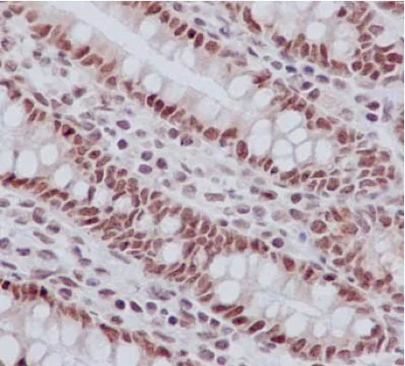 Immunohistochemistry (Formalin/PFA-fixed paraffin-embedded sections) - Anti-ACF1 / BAZ1A antibody [EPR15826] - C-terminal (AB187670)