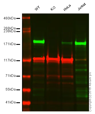 Western blot - Anti-ACF1 / BAZ1A antibody [EPR15826] - C-terminal (AB187670)