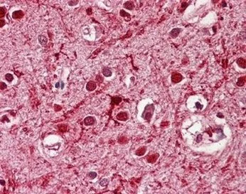 Immunohistochemistry (Formalin/PFA-fixed paraffin-embedded sections) - Anti-Achaete-scute homolog 3 antibody (AB166820)