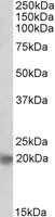 Western blot - Anti-Achaete-scute homolog 3 antibody (AB166820)