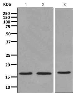 Western blot - Anti-Acid phosphatase/ACP1 antibody [EPR9839] (AB166896)