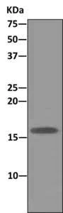 Immunoprecipitation - Anti-Acid phosphatase/ACP1 antibody [EPR9839] - BSA and Azide free (AB249379)