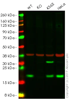 Western blot - Anti-Acid phosphatase/ACP1 antibody [EPR9839] - BSA and Azide free (AB249379)