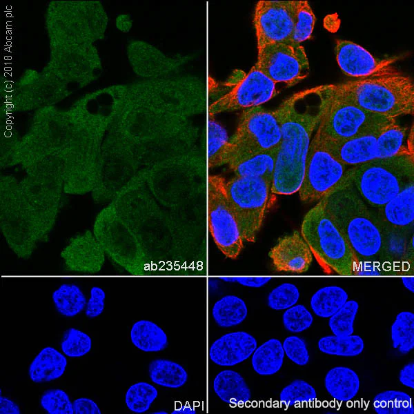 Immunocytochemistry/ Immunofluorescence - Anti-Acid phosphatase antibody [EPR21787] (AB235448)