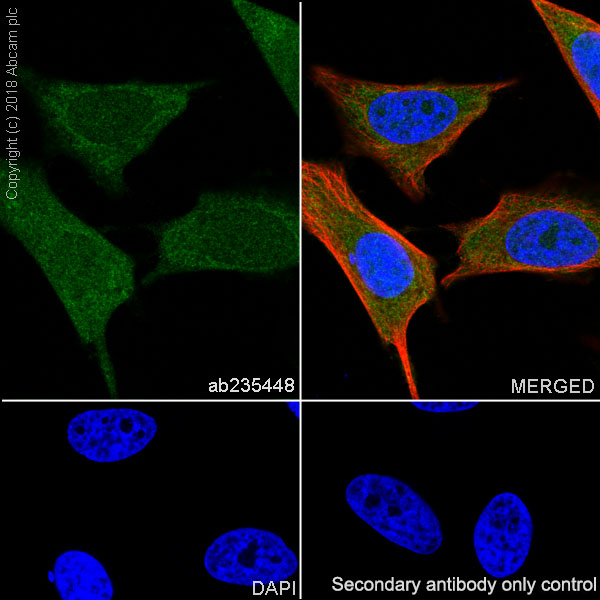 Immunocytochemistry/ Immunofluorescence - Anti-Acid phosphatase antibody [EPR21787] (AB235448)