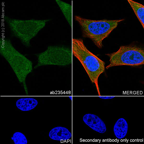 Immunocytochemistry/ Immunofluorescence - Anti-Acid phosphatase antibody [EPR21787] (AB235448)