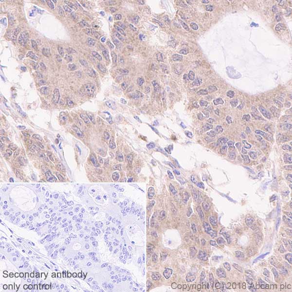 Immunohistochemistry (Formalin/PFA-fixed paraffin-embedded sections) - Anti-Acid phosphatase antibody [EPR21787] (AB235448)