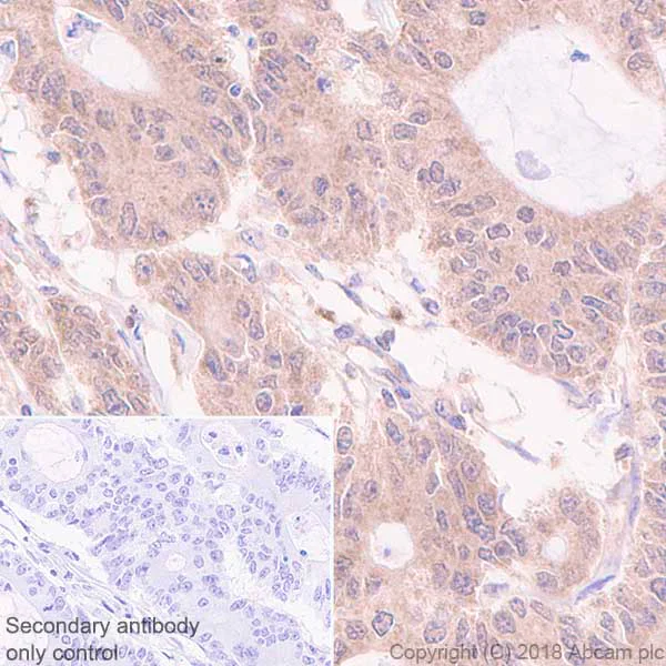 Immunohistochemistry (Formalin/PFA-fixed paraffin-embedded sections) - Anti-Acid phosphatase antibody [EPR21787] (AB235448)