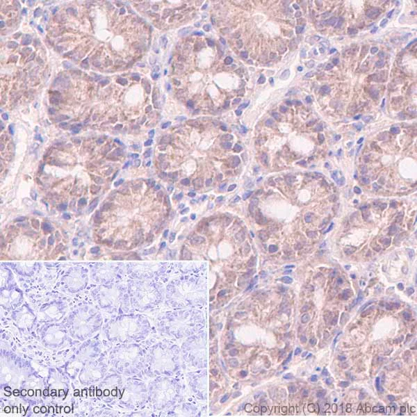 Immunohistochemistry (Formalin/PFA-fixed paraffin-embedded sections) - Anti-Acid phosphatase antibody [EPR21787] (AB235448)