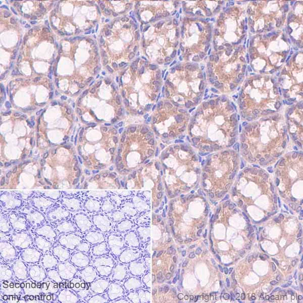 Immunohistochemistry (Formalin/PFA-fixed paraffin-embedded sections) - Anti-Acid phosphatase antibody [EPR21787] (AB235448)