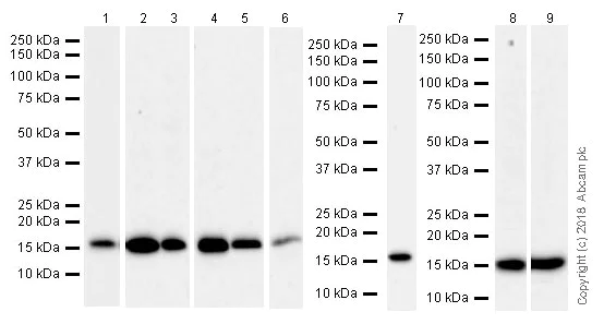 Western blot - Anti-Acid phosphatase antibody [EPR21787] (AB235448)