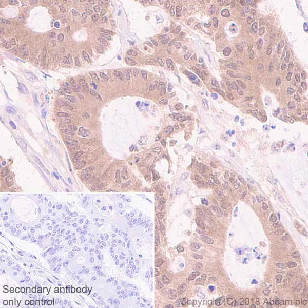 Immunohistochemistry (Formalin/PFA-fixed paraffin-embedded sections) - Anti-Acid phosphatase antibody [EPR21791] (AB235449)