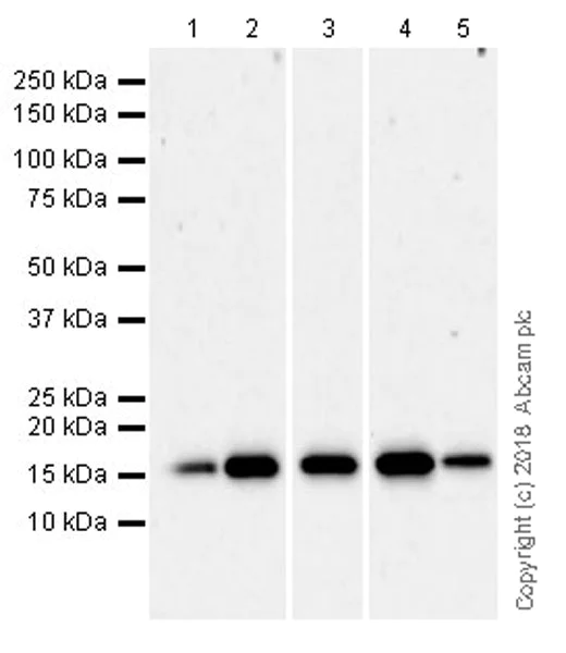 Western blot - Anti-Acid phosphatase antibody [EPR21791] (AB235449)