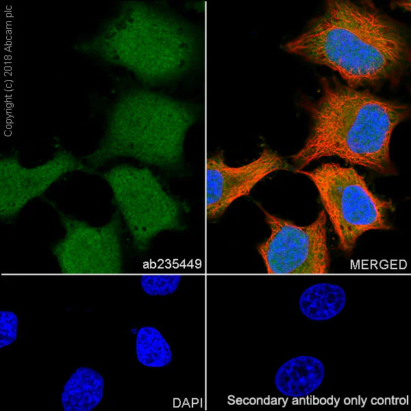 Immunocytochemistry/ Immunofluorescence - Anti-Acid phosphatase antibody [EPR21791] - BSA and Azide free (AB238913)