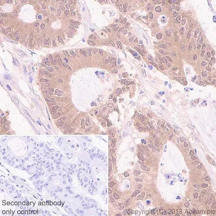 Immunohistochemistry (Formalin/PFA-fixed paraffin-embedded sections) - Anti-Acid phosphatase antibody [EPR21791] - BSA and Azide free (AB238913)