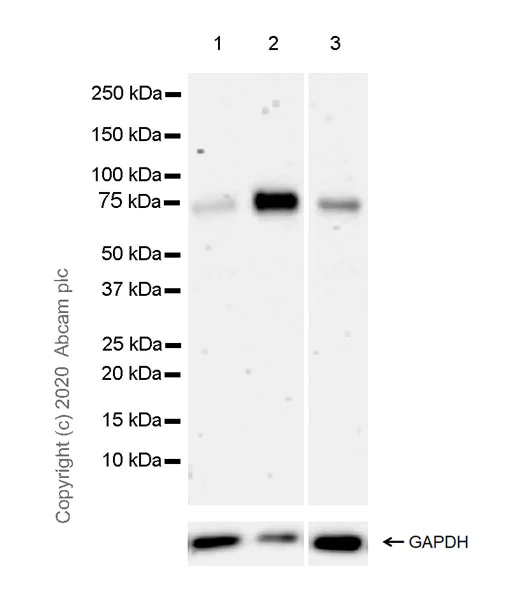 Western blot - Anti-Acid sphingomyelinase antibody [EPR23090-181] (AB272729)