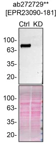 Western blot - Anti-Acid sphingomyelinase antibody [EPR23090-181] - BSA and Azide free (AB273510)