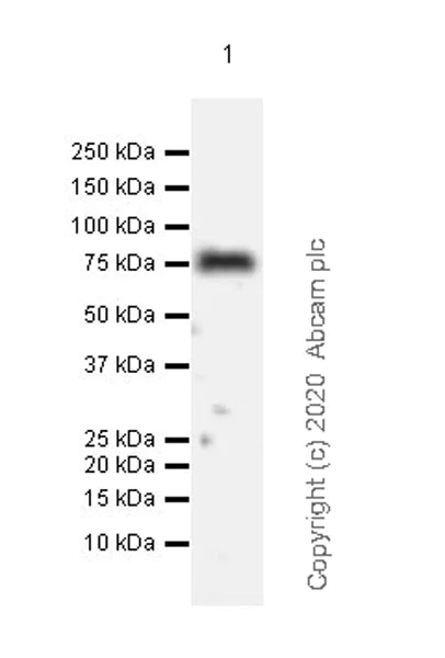 Western blot - Anti-Acid sphingomyelinase antibody [EPR23090-181] - BSA and Azide free (AB273510)