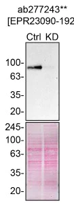 Western blot - Anti-Acid sphingomyelinase antibody [EPR23090-192] - BSA and Azide free (Capture) (AB277243)