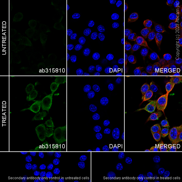 Immunocytochemistry/ Immunofluorescence - Anti-Acid sphingomyelinase antibody [EPR28613-49] (AB315810)