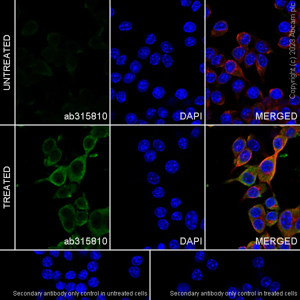 Immunocytochemistry/ Immunofluorescence - Anti-Acid sphingomyelinase antibody [EPR28613-49] - BSA and Azide free (AB315811)