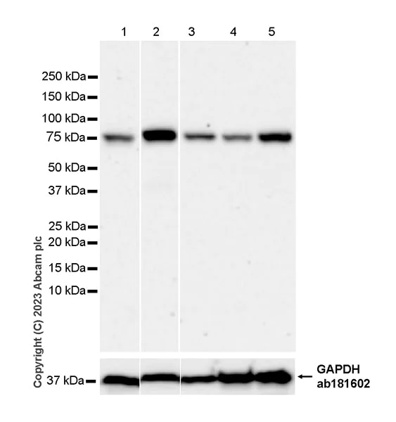 Western blot - Anti-Acid sphingomyelinase antibody [EPR28613-49] - BSA and Azide free (AB315811)