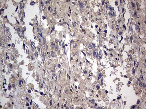 Immunohistochemistry (Formalin/PFA-fixed paraffin-embedded sections) - Anti-Acid sphingomyelinase antibody [OTI3H7] - BSA and Azide free (AB273656)