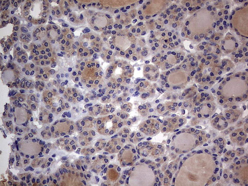 Immunohistochemistry (Formalin/PFA-fixed paraffin-embedded sections) - Anti-Acid sphingomyelinase antibody [OTI3H7] - BSA and Azide free (AB273656), expandable thumbnail