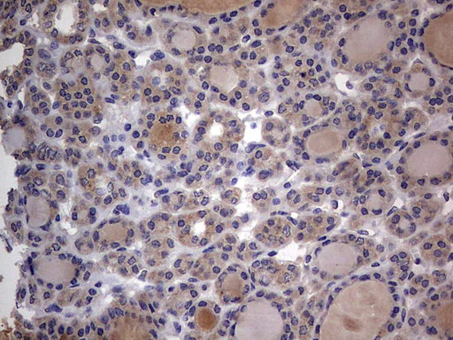 Immunohistochemistry (Formalin/PFA-fixed paraffin-embedded sections) - Anti-Acid sphingomyelinase antibody [OTI3H7] - BSA and Azide free (AB273656)
