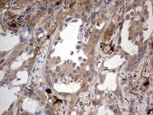 Immunohistochemistry (Formalin/PFA-fixed paraffin-embedded sections) - Anti-Acid sphingomyelinase antibody [OTI3H7] - BSA and Azide free (AB273656)