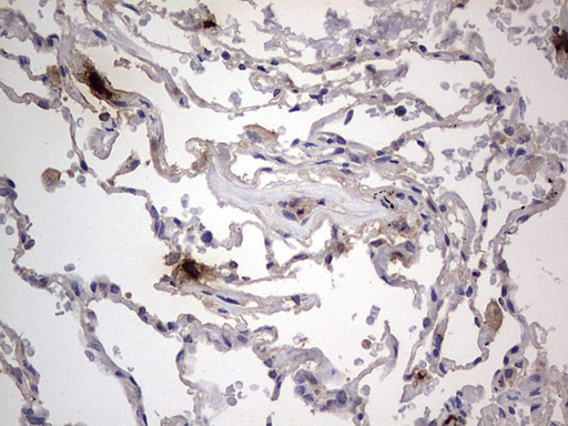 Immunohistochemistry (Formalin/PFA-fixed paraffin-embedded sections) - Anti-Acid sphingomyelinase antibody [OTI3H7] - BSA and Azide free (ab273656), expandable thumbnail