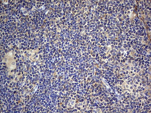 Immunohistochemistry (Formalin/PFA-fixed paraffin-embedded sections) - Anti-Acid sphingomyelinase antibody [OTI3H7] - BSA and Azide free (AB273656)