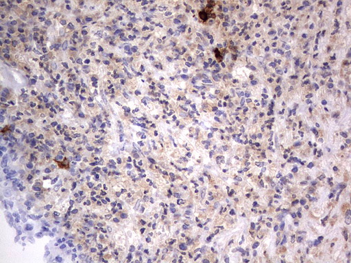 Immunohistochemistry (Formalin/PFA-fixed paraffin-embedded sections) - Anti-Acid sphingomyelinase antibody [OTI3H7] - BSA and Azide free (ab273656), expandable thumbnail